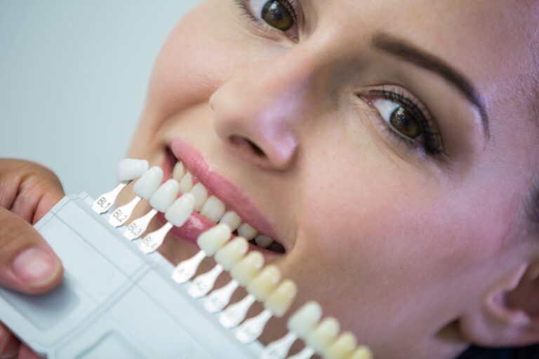 lente de contato dental dói | Clínica Odontológica em Pinheiros | Nipodonto