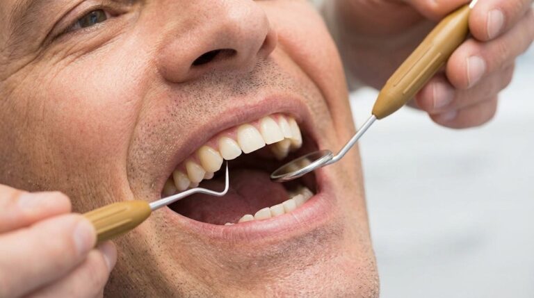 limpeza dental | Clínica Odontológica em Pinheiros | Nipodonto